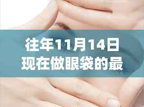 超越岁月痕迹,揭秘最新眼袋消除术,重拾自信光芒的眼部年轻化秘籍