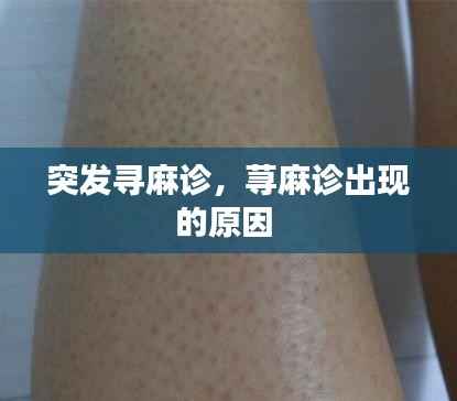 突发寻麻诊,荨麻诊出现的原因