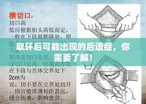 取环后可能出现的后遗症,你需要了解!